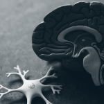 Post Concussion Syndrome