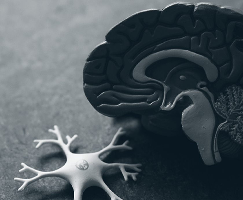 post concussion syndrome