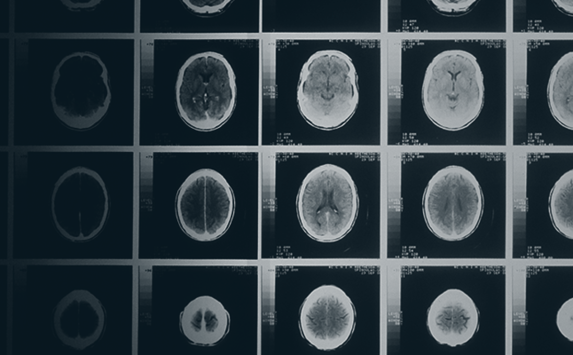 concussion awareness