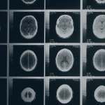 Concussion Awareness Week